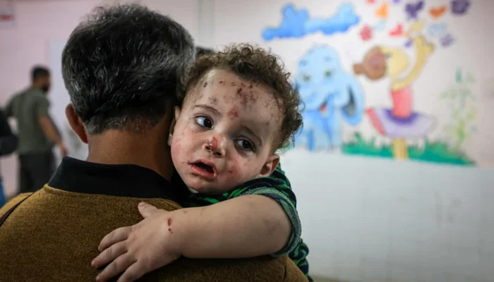 اٹلی کا 100 زخمی فلسطینی بچوں کا علاج کرانے کا اعلان