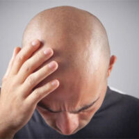 مردوں میں گنج پن کی بڑی وجہ سامنے آ گئی: نئی تحقیق میں حیران کن انکشاف