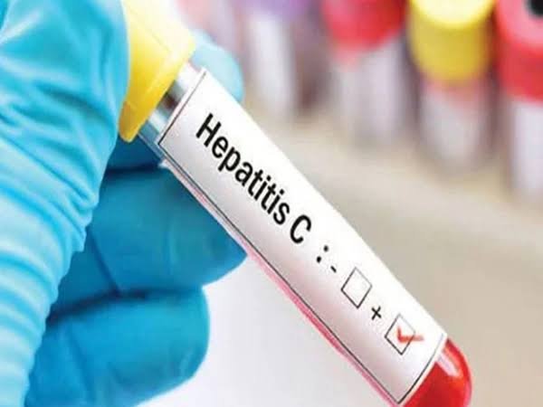 ہیپاٹائٹس سی کے مریض ایک کروڑ 10 لاکھ سے تجاوز